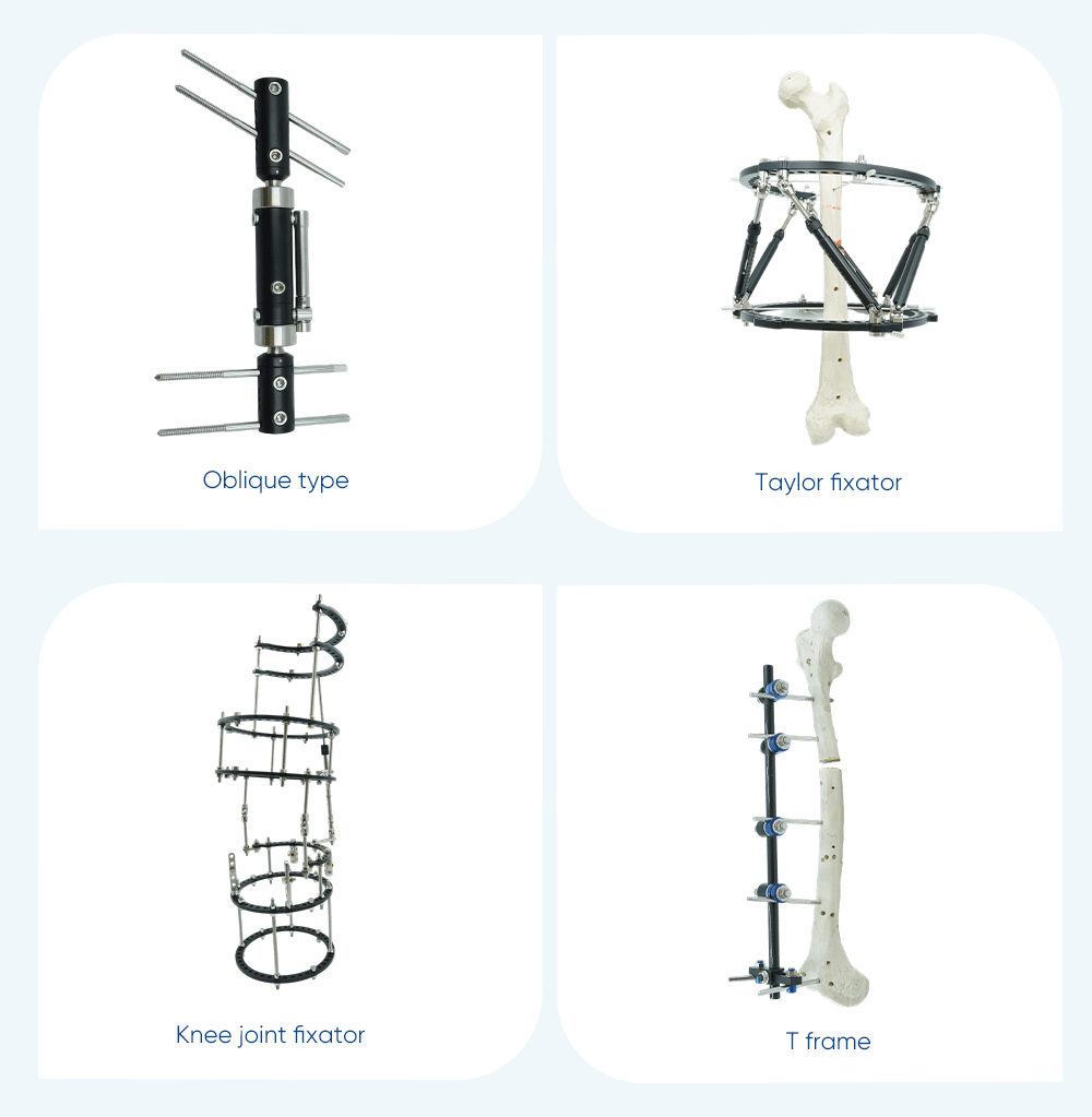 External Fixator for Leg - Buy Product on XC Medico  External Fixator for Leg - Buy Product on XC Medico