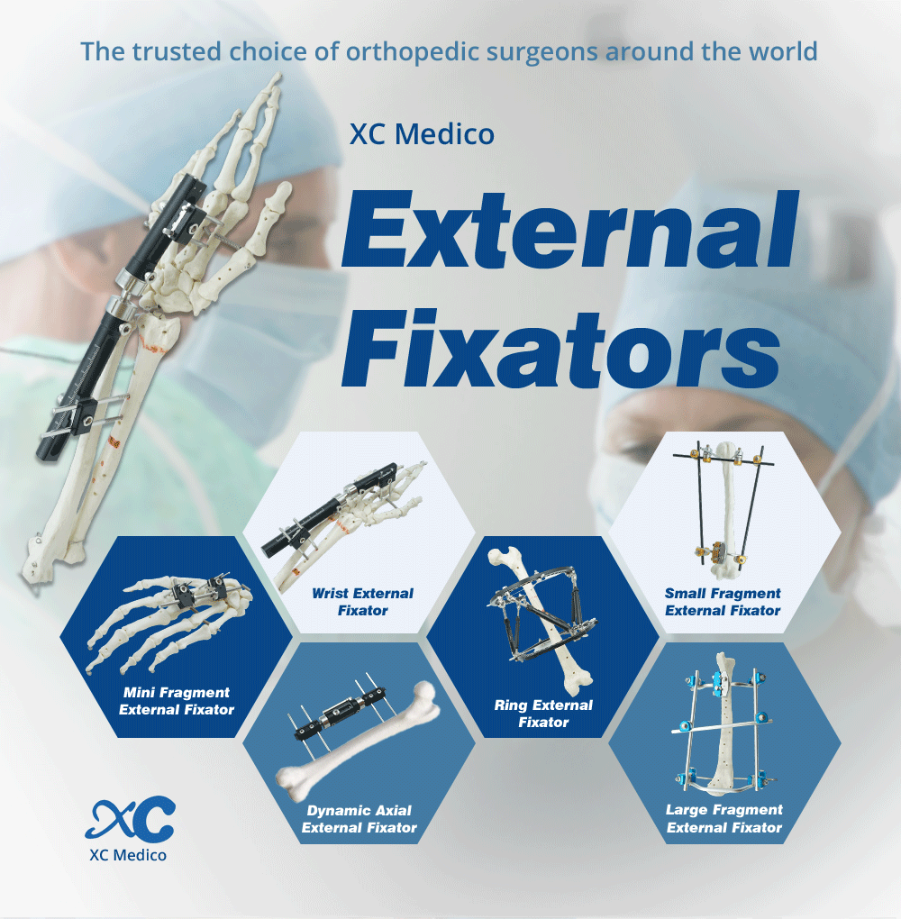 Wrist External Fixator - Buy Product on XC Medico Wrist External Fixator - Buy Product on XC Medico