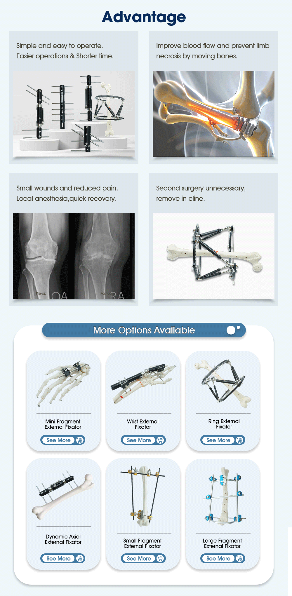 External Fixator for Leg - Buy Product on XC Medico  External Fixator for Leg - Buy Product on XC Medico