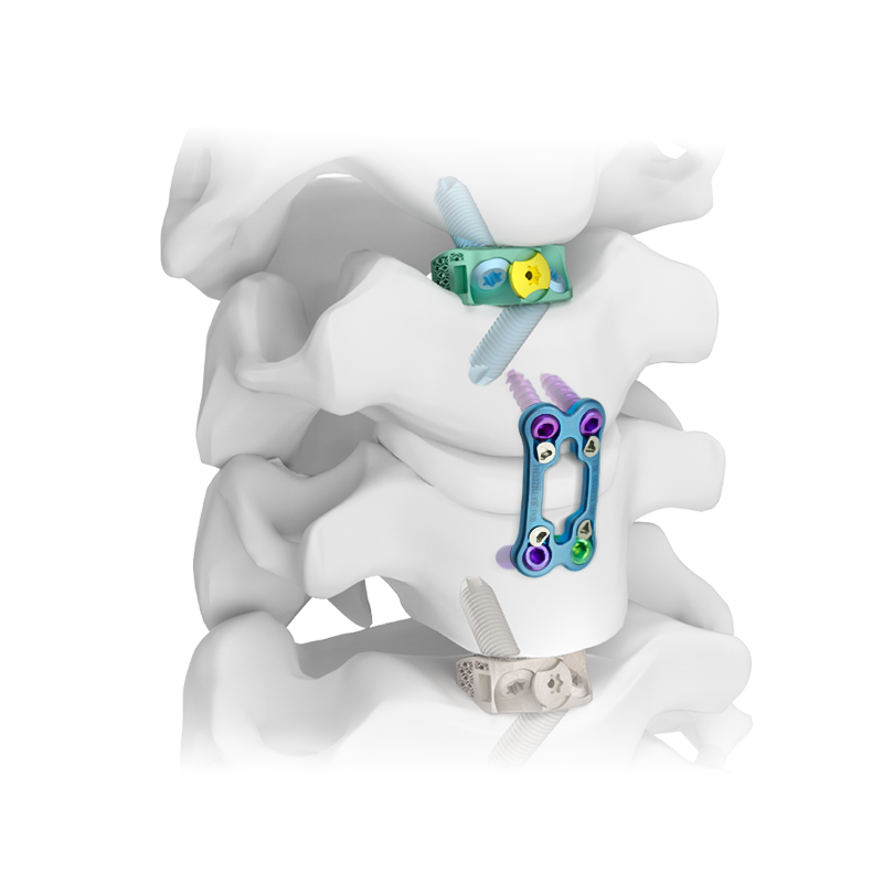 Orthopedic & Spine Impairment Overview