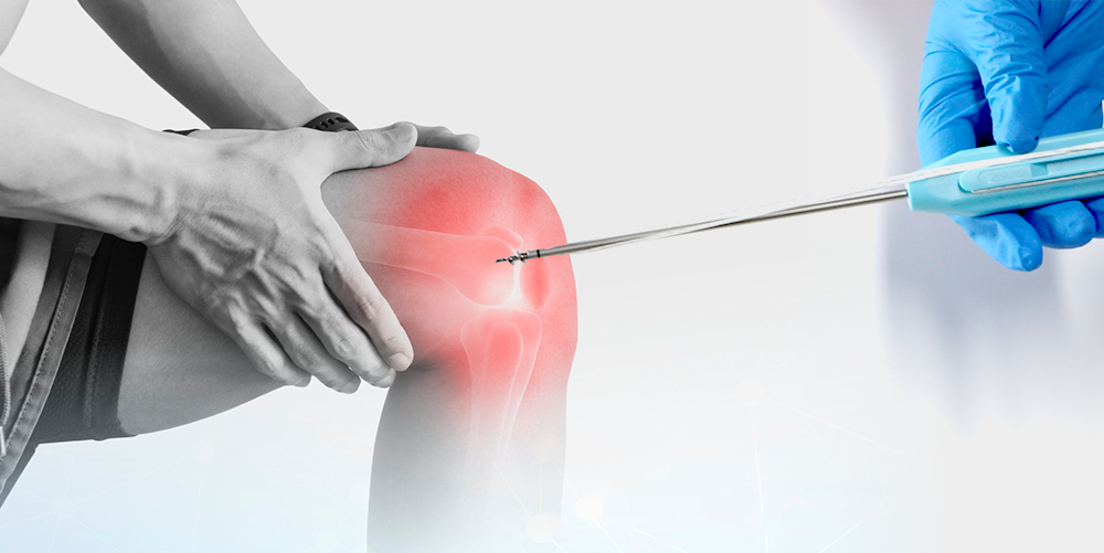 Titanium Suture Anchor | Ligament Repair Implant for Shoulder & Knee | XC Medico Titanium Suture Anchor | Ligament Repair Implant for Shoulder & Knee | XC Medico