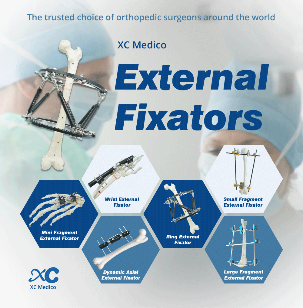 External Fixator for Leg - Buy Product on XC Medico  External Fixator for Leg - Buy Product on XC Medico