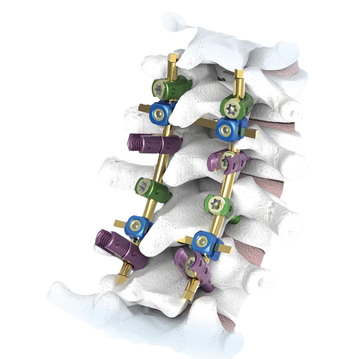 Implications for Orthopedic Impairment