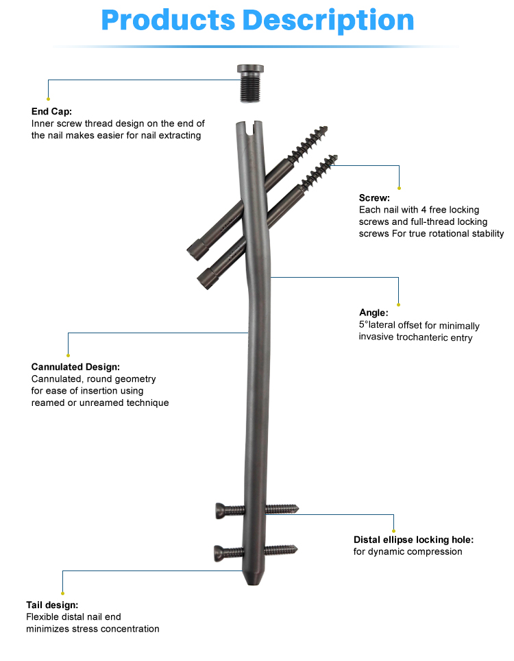 Titanium Gamma Nail | Proximal Femoral Fracture Fixation Implants - XC Medico - 2 Titanium Gamma Nail | Proksimaaliset reisiluun murtuman kiinnitysimplantit - XC Medico - 2
