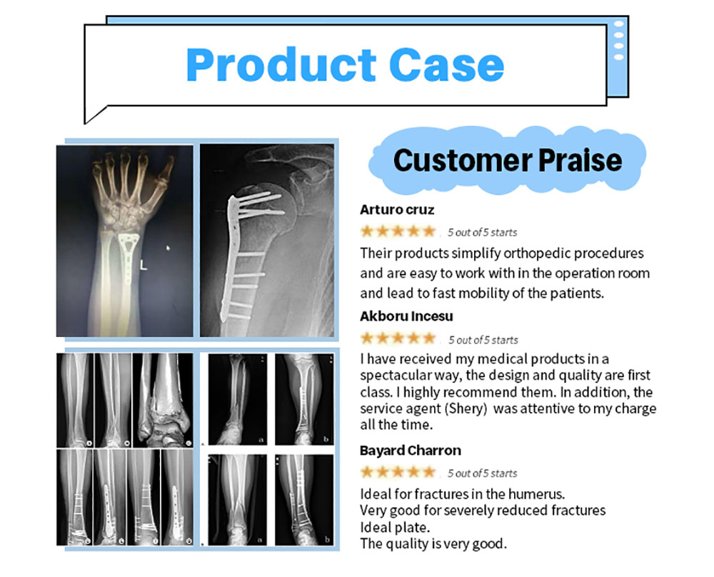 Locking-Proximal-Humerus-Plate-(LPHP)_04 Locking-Prossimal-Humerus-Plate-(LPHP)_04