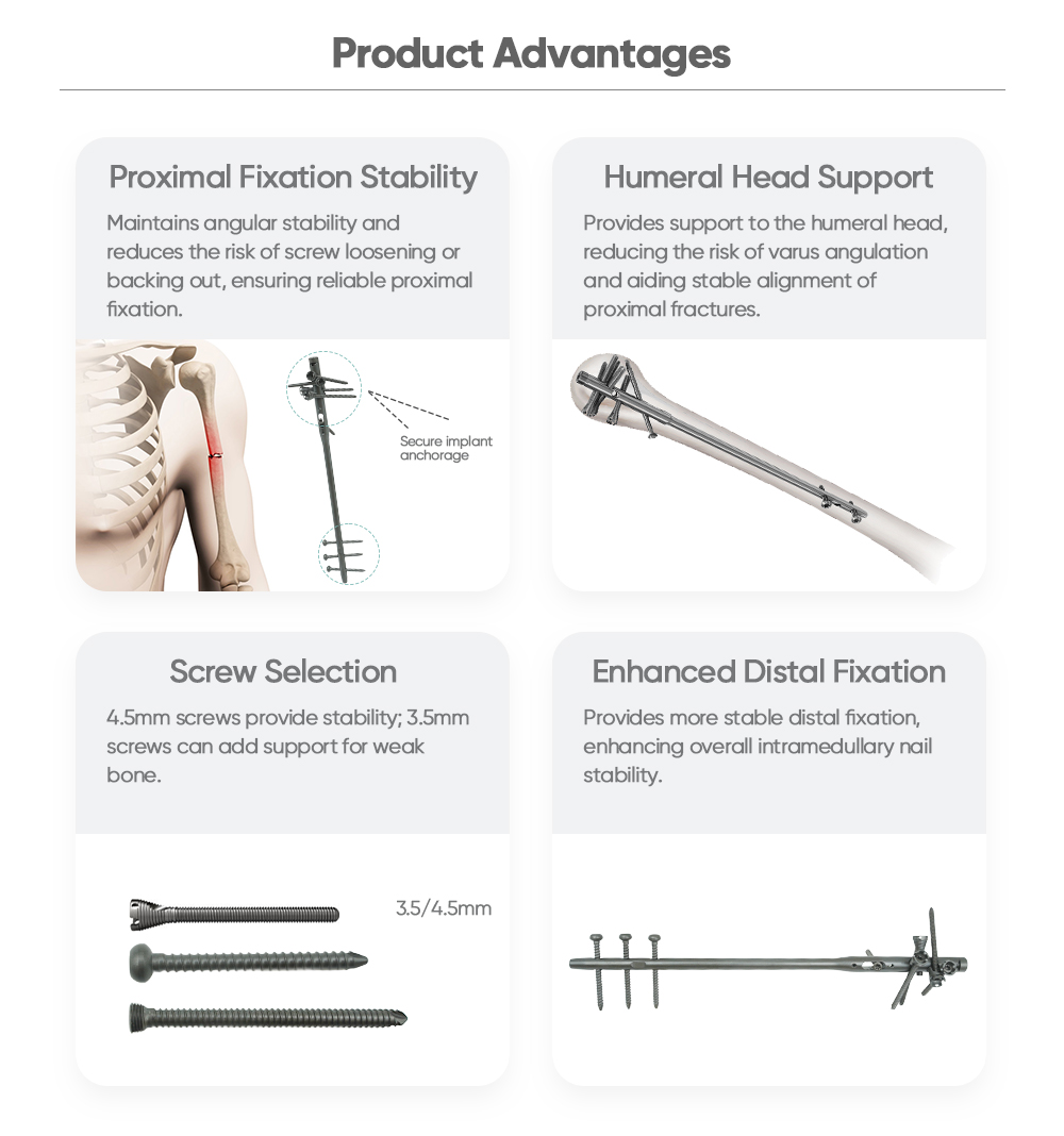 Humerus Multi-Lock Intramedullary Nail - Buy Product on XC Medico