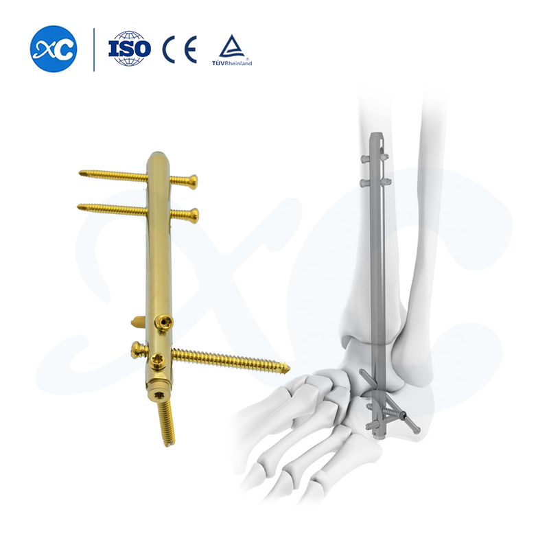 Hindfoot Fusion Ankle Nail - Buy Product on XC Medico