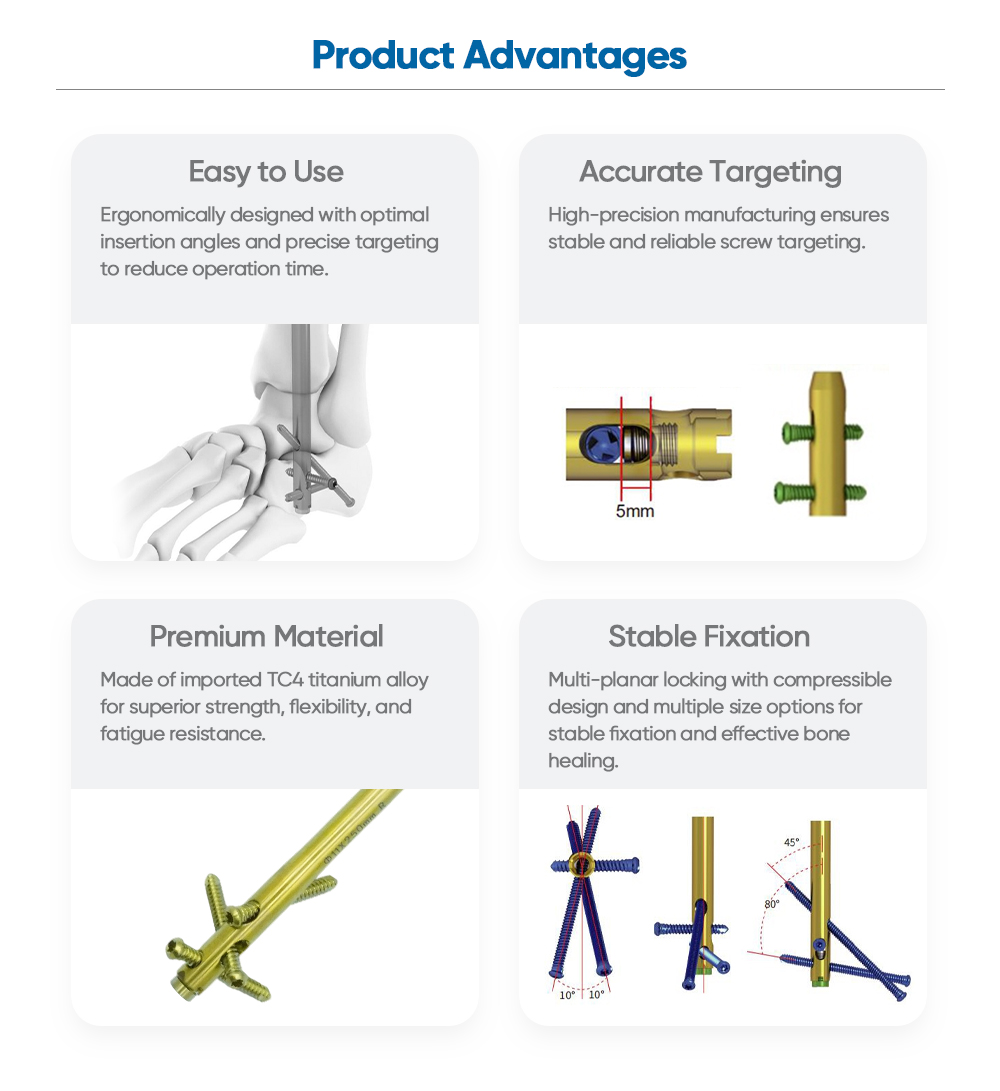 Hindfoot Fusion Ankle Nail - Buy Product on XC Medico