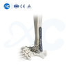 Distal Tibiofibular Locking Plate-III - Buy Product on XC Medico