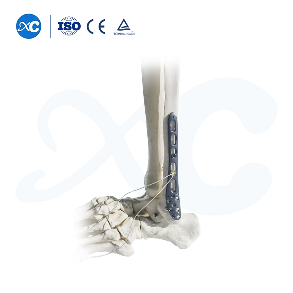 Distal Tibiofibular Locking Plate-III - Buy Product on XC Medico