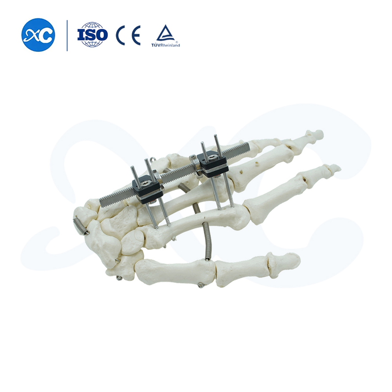 Mini Fixator Straight Type