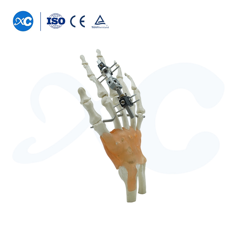 Mini Fixator Joint Motion Type