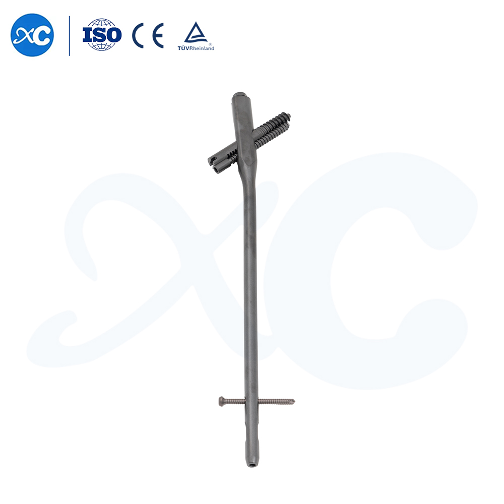 Intertan Nail System | Anti-Rotation Femoral Interlocking Nail | Eliminates Z-Effect