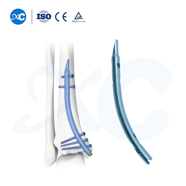Distal Tibial Nail | Retrograde Intramedullary Fixation System | XC Medico Orthopedics