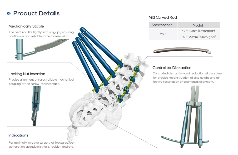 MisFix 5.5 Components: Coaxial Pedicle Screw, Polyaxial Screw, Curved Rod, and Locking Nut