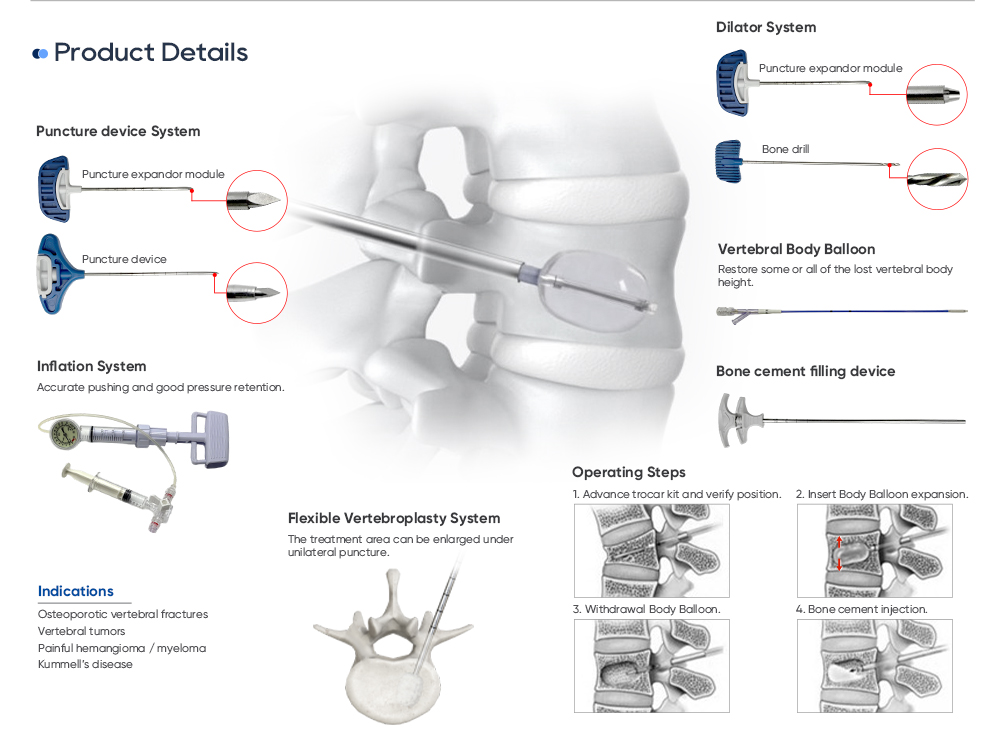 Premium Titanium Alloy and High-Precision CNC Machining for Kyphoplasty Surgical Instruments