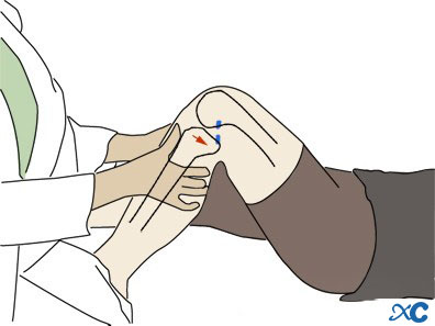 Knee Joint