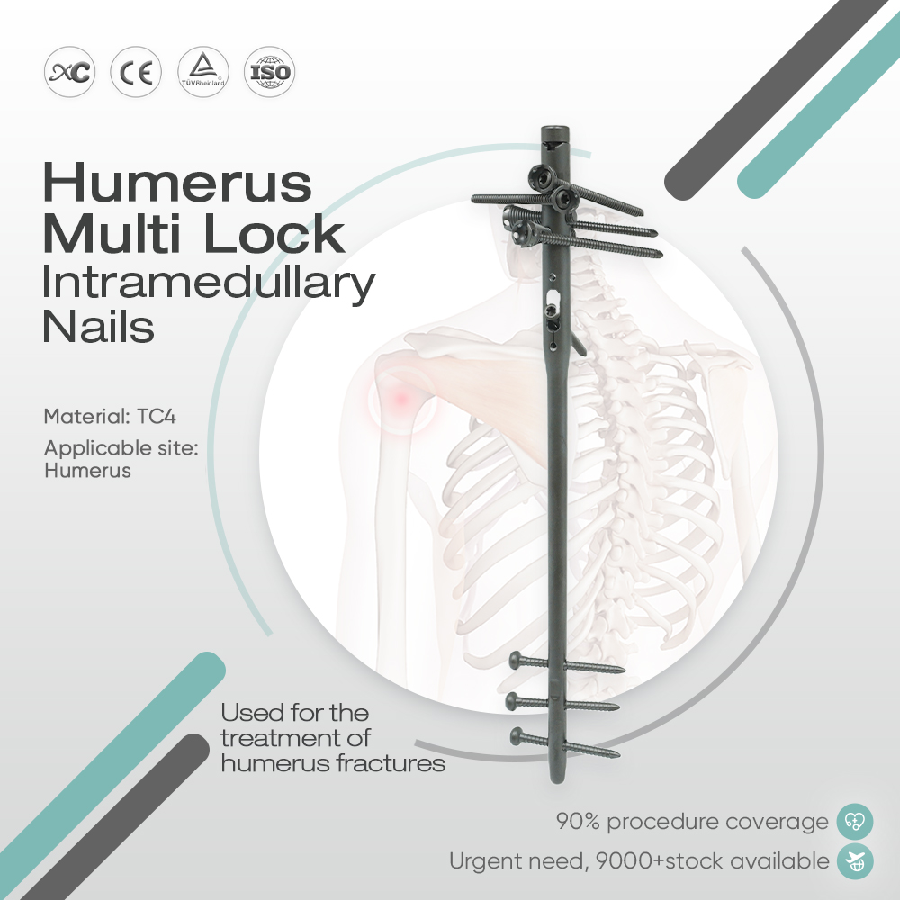 Humerus Multi-Lock Intramedullary Nail - Buy Product on XC Medico