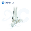 Distal Tibiofibular Locking Plate-III - Buy Product on XC Medico