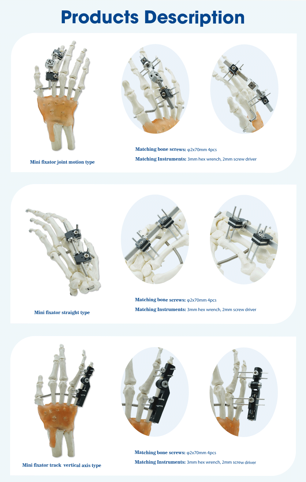 External Fixation Of Metacarpals And Phalanges - Image 3