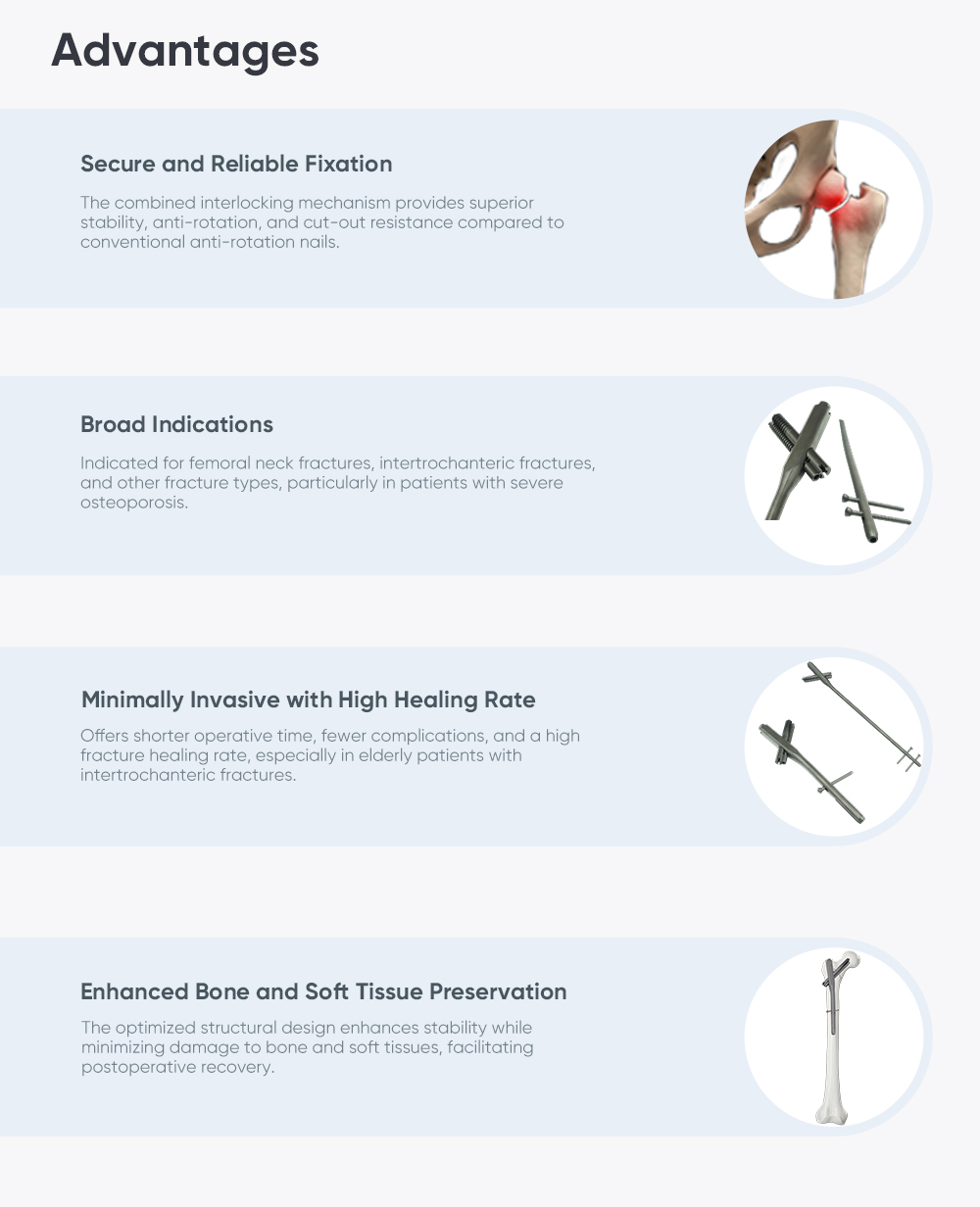 Intertan Intramedullary Nail System – Proximal Femoral Fracture Fixation