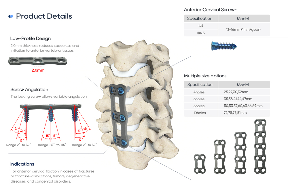 Plaque cervicale ant&eacute;rieure en alliage de titane machined CNC &agrave; haute pr&eacute;cision oyo esimbami na monganga ya lipaso