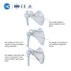 Plat mengunci scapula
