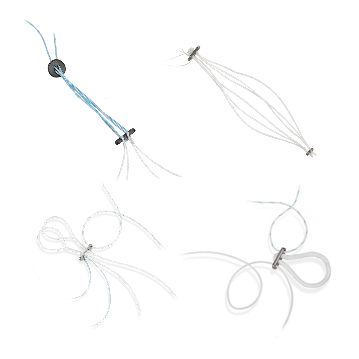 Ligament Fixation System