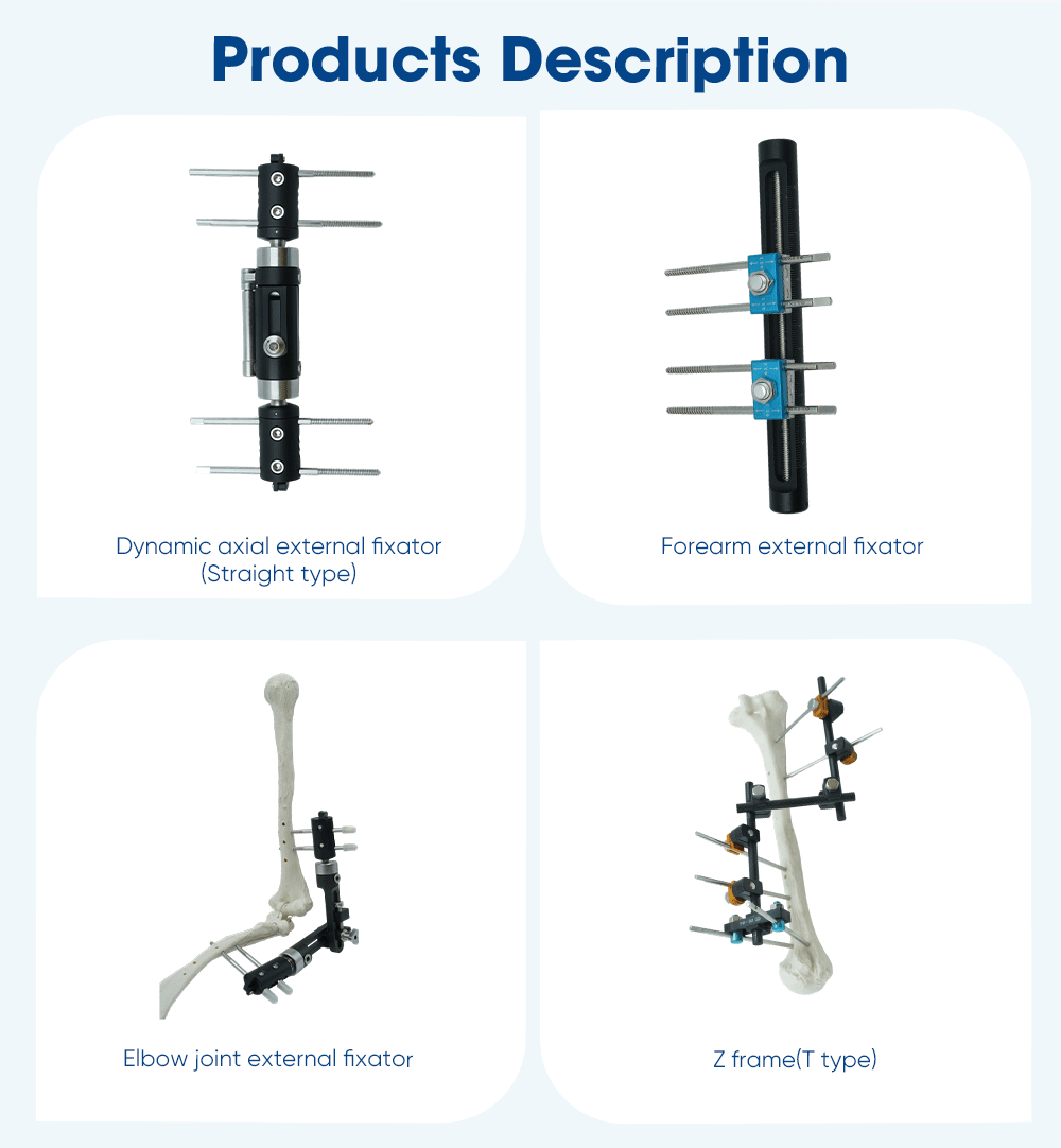 Upper Limb External Fixators - Buy Product on XC Medico