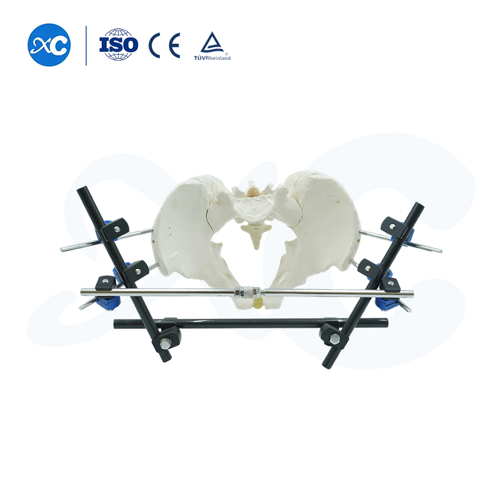 Pelvic & Ankle Fixator External - Buy Product on XC Medico