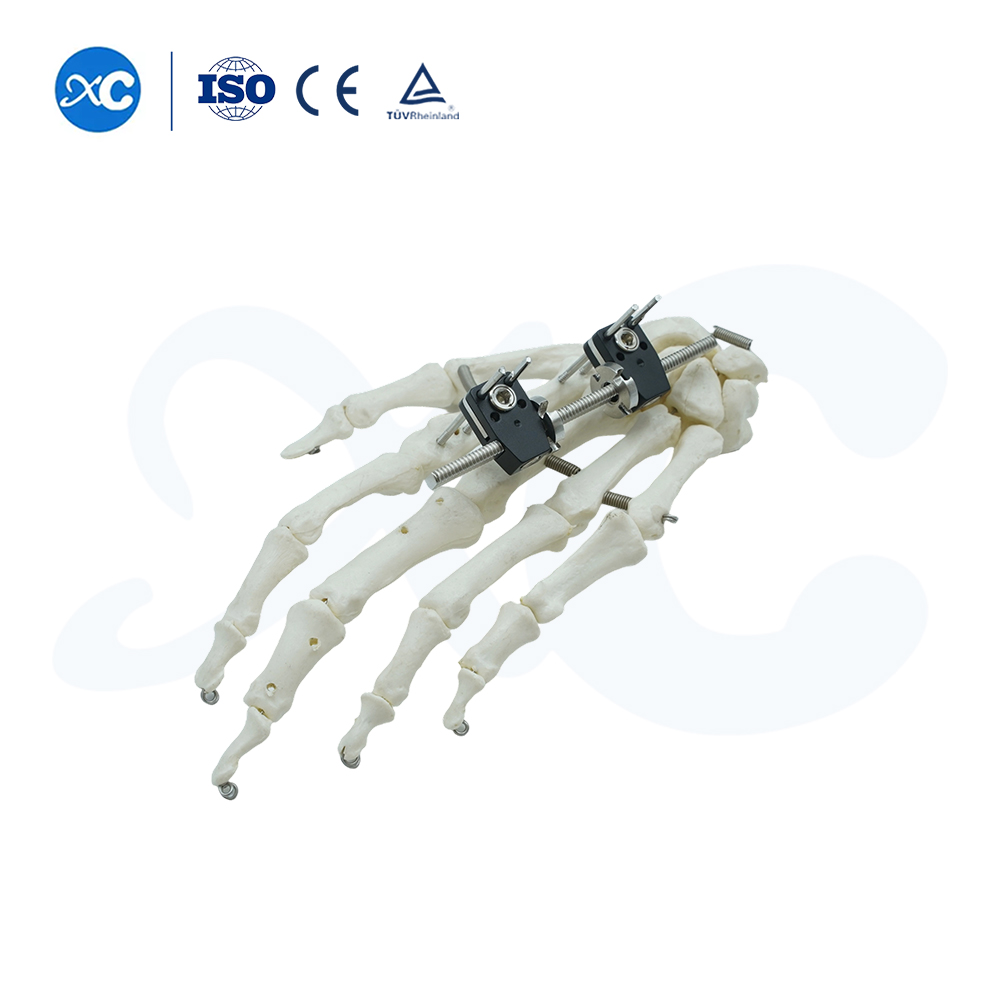 Mini Fixator Straight Type