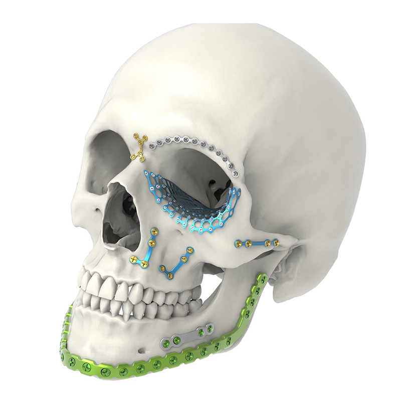 CMF-Maxillofacial