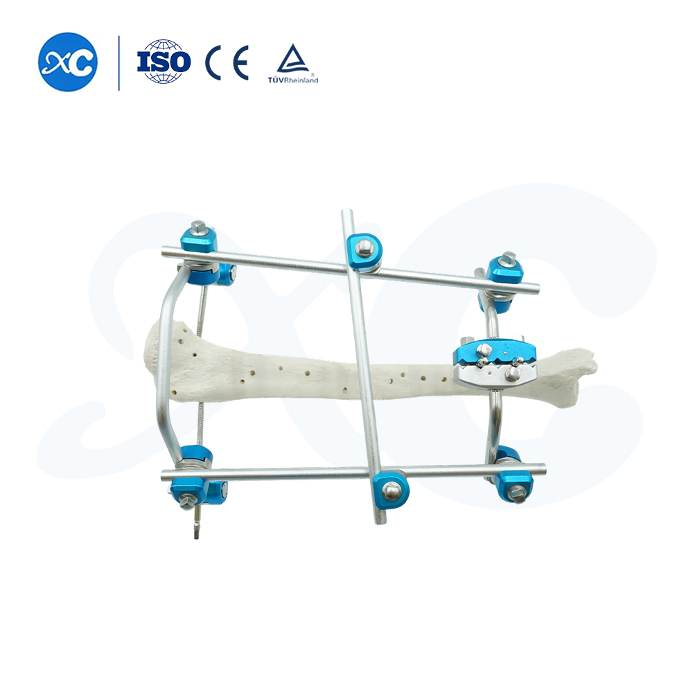  External Fixator for Leg - Buy Product on XC Medico