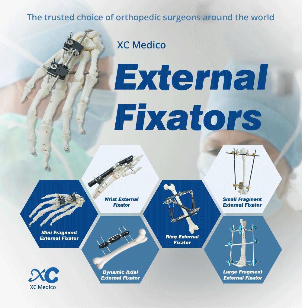 External Fixation Of Metacarpals And Phalanges - Image 1