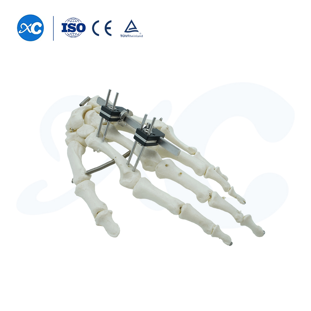 Mini Fixator Straight Type