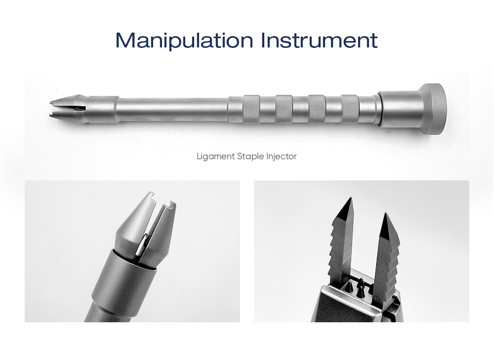 Ligament Staple | Soft Tissue Fixation for ACL Reconstruction | XC Medico Sports Medicine