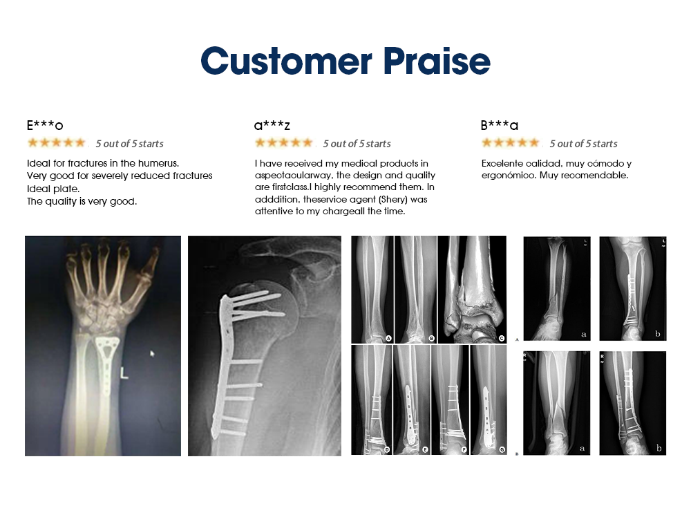 Small Fragment Instrument Set - XC Medico