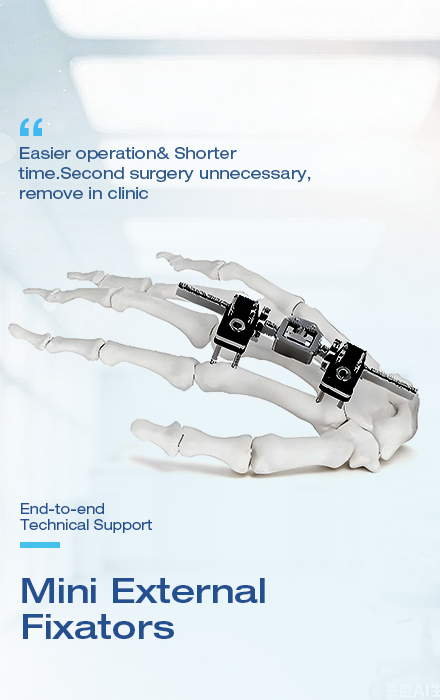 Mini External Fixators
