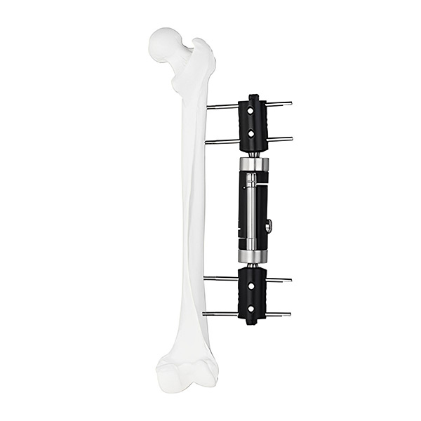 Dynamic-Axial-External-Fixator