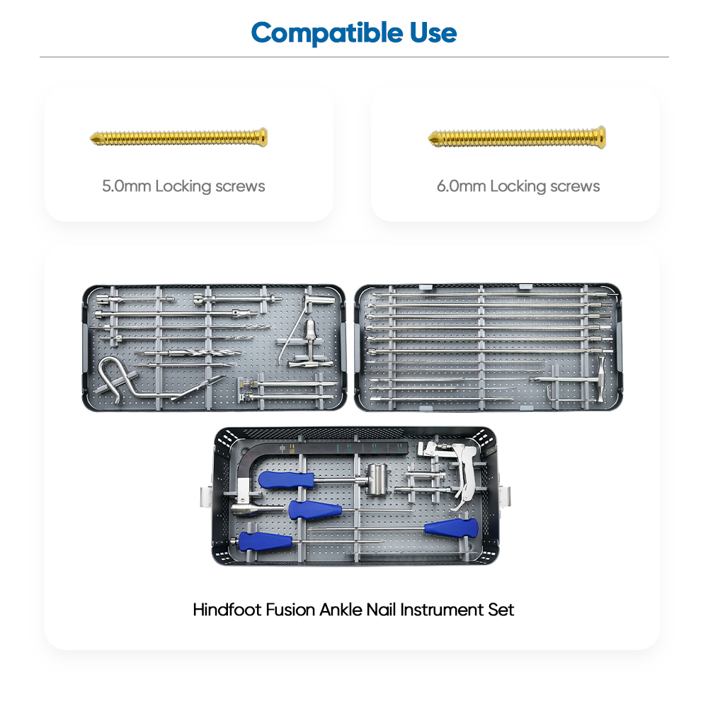 Hindfoot Fusion Ankle Nail - Buy Product on XC Medico
