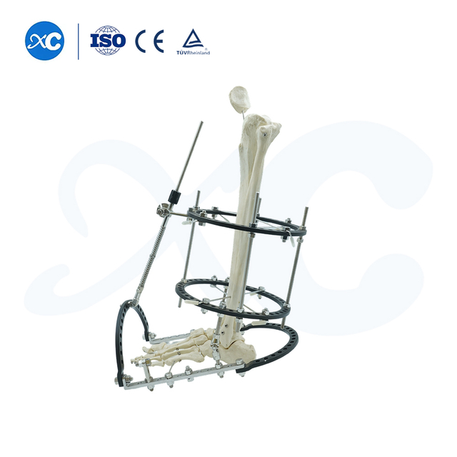 Pelvic & Ankle Fixator External - Buy Product on XC Medico