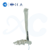 Distal Tibiofibular Locking Plate-III - Buy Product on XC Medico