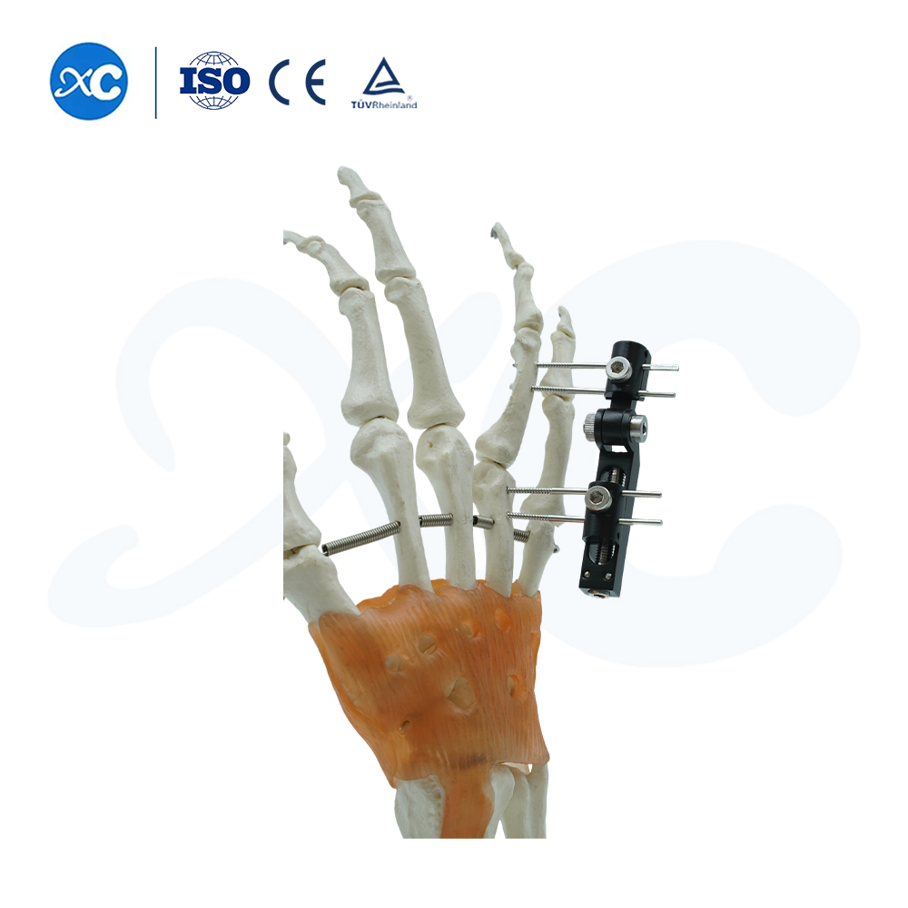 Mini Fixator Track Vertical Axis Type