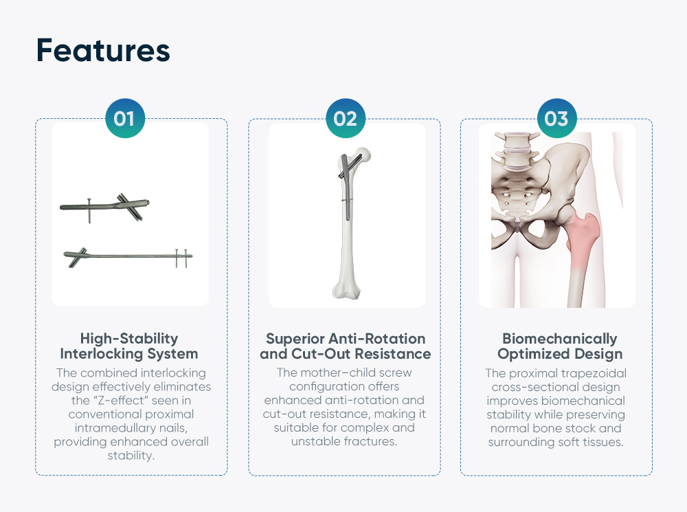 Intertan Intramedullary Nail System – Proximal Femoral Fracture Fixation
