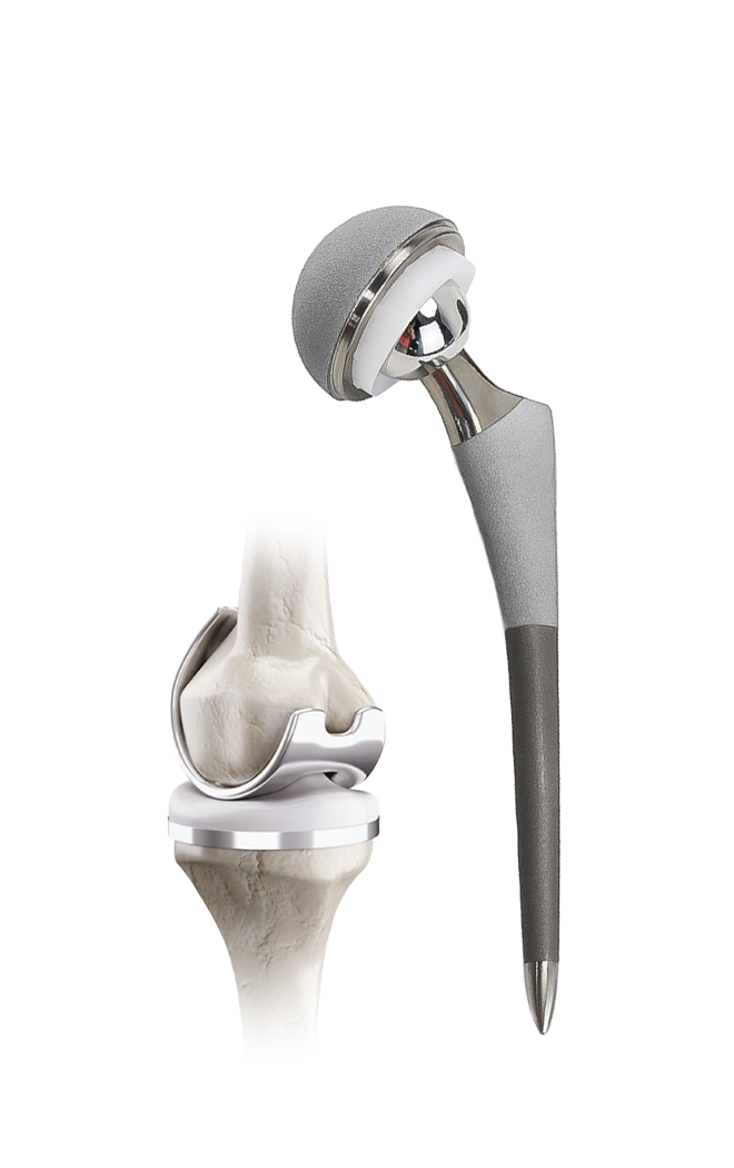 Joint Reconstruction