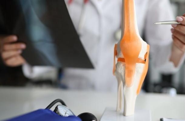 Kestirib va ​​tizzali bo'g'inlar - 5