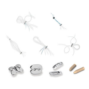 Ligament Fixation System
