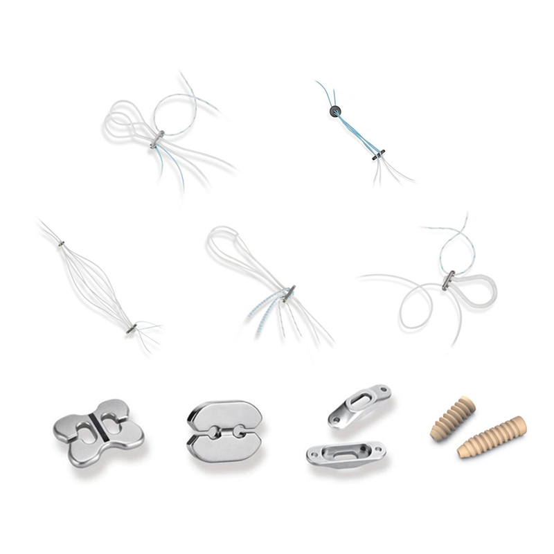 Ligament Fixation System
