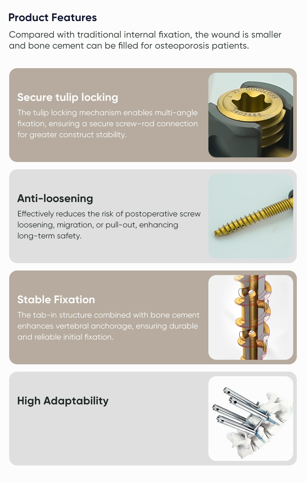 MIS 5.5 cement-augmented fenestrated screw