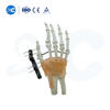 External Fixation for Metacarpals And Phalanges - Buy Product on XC Medico